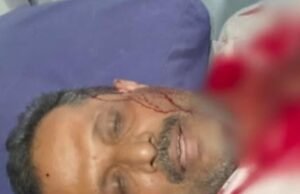 ಗ್ರಾಹಕಿ ಸೋಗಿನಲ್ಲಿ ಬುರ್ಖಾ ಧರಿಸಿ ಬಂದು ಪತಿಯ ಮೇಲೆ ಕತ್ತಿಯಿಂದ ಹಲ್ಲೆ…!!