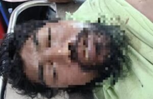 ಉಡುಪಿ ಸಿಟಿ ಬಸ್ ನಿಲ್ದಾಣದ ಬಳಿ ಪ್ರಜ್ಞಾಹೀನ ಸ್ಥಿತಿಯಲ್ಲಿದ್ದ ನೇಪಾಳ ಪ್ರಜೆ ಸಾವು…!!