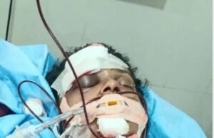 ಕೌಟುಂಬಿಕ ಕಲಹ ಹಿನ್ನೆಲೆ : ಪತಿಯಿಂದಲೇ ಪತ್ನಿಗೆ ಮಾರಣಾಂತಿಕ ಹಲ್ಲೆ, ಮಹಿಳೆ ಗಂಭೀರ…!!