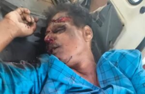 ಹೊನ್ನಾವರ : ಭೀಕರ ರಸ್ತೆ ಅಪಘಾತದಲ್ಲಿ ಬೈಕ್ ಸವಾರ ಮೃತ್ಯು…!!