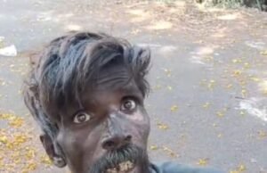 ಗಂಭೀರ ಸ್ಥಿತಿಯಲ್ಲಿದ್ದ ಅಪರಿಚಿತನ ರಕ್ಷಣೆ : ಸೂಚನೆ…!!