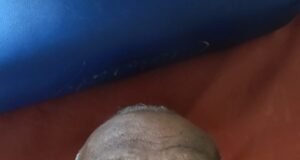 ಉಡುಪಿ: ಜಿಲ್ಲಾಸ್ಪತ್ರೆಯಲ್ಲಿ ಚಿಕಿತ್ಸೆ ಫಲಕಾರಿಯಾಗದೆ ವೃದ್ಧರ ನಿಧನ…!!