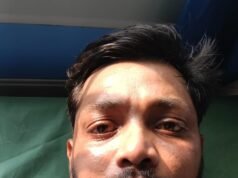 ಉಡುಪಿ: ಸಾರ್ವಜನಿಕ ಸ್ಥಳದಲ್ಲಿ ಉಗ್ರ ವರ್ತನೆ, ಯುವಕ ಅಜ್ಜರಕಾಡು ಜಿಲ್ಲಾಸ್ಪತ್ರೆಗೆ ದಾಖಲು