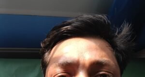 ಉಡುಪಿ: ಸಾರ್ವಜನಿಕ ಸ್ಥಳದಲ್ಲಿ ಉಗ್ರ ವರ್ತನೆ : ಯುವಕ ಅಜ್ಜರಕಾಡು ಜಿಲ್ಲಾಸ್ಪತ್ರೆಗೆ ದಾಖಲು…!