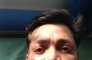 ಉಡುಪಿ: ಸಾರ್ವಜನಿಕ ಸ್ಥಳದಲ್ಲಿ ಉಗ್ರ ವರ್ತನೆ : ಯುವಕ ಅಜ್ಜರಕಾಡು ಜಿಲ್ಲಾಸ್ಪತ್ರೆಗೆ ದಾಖಲು…!