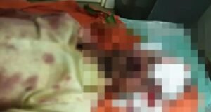 ಬಂಟ್ವಾಳ: ಕಲ್ಲಿನಿಂದ ಹಲ್ಲೆ : ಯುವಕನಿಗೆ ಗಾಯ : ಆರೋಪಿ ಪೊಲೀಸ್ ವಶಕ್ಕೆ…!!