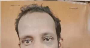 ಬಿಸಿ ಕೆಮಿಕಲ್ ಎರಚಿ ಕೊಲೆಗೆ ಯತ್ನ ಪ್ರಕರಣ: ಆರೋಪಿಗೆ 10 ವರ್ಷ ಕಠಿಣ ಕಾರಾಗೃಹ ಶಿಕ್ಷೆ