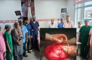ಉಡುಪಿ: ಮಹಿಳೆಯ ಗರ್ಭಕೋಶದಿಂದ 8 ಕೆ.ಜಿ. ಗಡ್ಡೆ ಯಶಸ್ವಿ ಶಸ್ತ್ರಚಿಕಿತ್ಸೆಯಿಂದ ತೆರವು…!