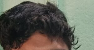 ಅತಿವೇಗ ಹಾಗೂ ಅಜಾಗರೂಕತೆಯ ಚಾಲನೆ : ಬೈಕ್ ಸವಾರನ ಸಾವಿಗೆ ಕಾರಣನಾದ ಲಾರಿ ಚಾಲಕ ಅರೆಸ್ಟ್…!!