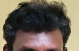 ಕೊಲೆ ಯತ್ನ ಆರೋಪಿಗೆ 10 ವರ್ಷ ಜೈಲು ಶಿಕ್ಷೆ : 50 ಸಾವಿರ ದಂಡ….!!