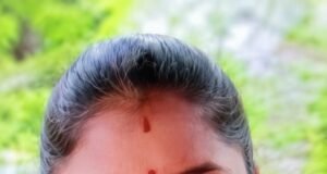 ಕಾರ್ಕಳ: ಅಪಘಾತದಲ್ಲಿ ಗಂಭೀರ ಗಾಯ : 10 ತಿಂಗಳ ಬಳಿಕ ಚಿಕಿತ್ಸೆ ಫಲಿಸದೆ ಮಹಿಳೆ ಸಾವು…!!