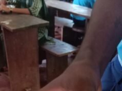 ಶಾಲಾ ಮಕ್ಕಳ ಊಟದಲ್ಲಿ ಹಾಳಾದ ಮೊಟ್ಟೆ ಪತ್ತೆ…!!