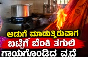 ಕಾಪು: ಅಡುಗೆ ಮಾಡುತ್ತಿರುವಾಗ ಬಟ್ಟೆಗೆ ಬೆಂಕಿ ತಗುಲಿ ಗಾಯಗೊಂಡಿದ್ದ ವೃದ್ಧೆ ಸಾವು…!!